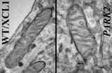 Mitochondria are altered in human cell model of Parkinsons disease