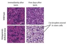 Mitochondria found to be protected by ketogenesis