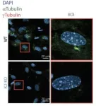 Mitochondria pore emerges as potential key to managing muscular dystrophies 2