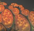 Mitochondrial mutations: When the cell's 2 genomes collide