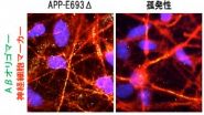 Modeling Alzheimers disease using iPSCs