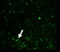 Molecular regulation of hypoxic-ischemic brain damage