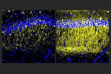 Molecule reduces inflammation in Alzheimer’s models