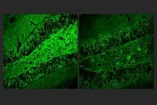 Molecule reduces inflammation in Alzheimer’s models 2