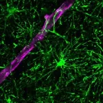 More than just neurons: A new model for studying human brain inflammation 2