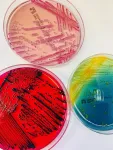 More than thirty new species of bacteria discovered in patient samples