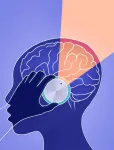 Mount Sinai study shows that human beliefs about drugs could have dose-dependent effects on the brain