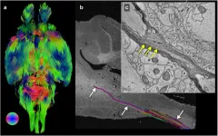 Mouse brain imaged from the microscopic to the macroscopic level