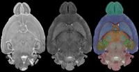 Mouse brain seen in sharpest detail ever