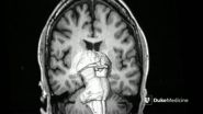 MRI technology reveals deep brain pathways in unprecedented detail 2