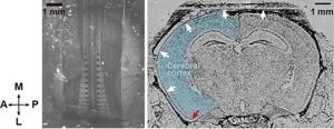 Multisensory information detection by using multi-channel electrocorticography film that can place over a wide area of the cerebral cortex 2