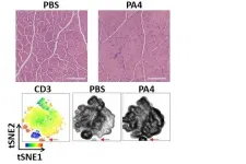 Muscling up with nanoparticle-based anti-inflammatory therapy