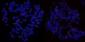 Mystery solved: how tumor cells die after radiotherapy