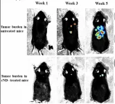 Nanodiamonds block tumor metastasis in mice