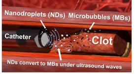 Nanodroplets and ultrasound drills prove effective at tackling tough blood clots