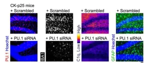 Nanoparticle-delivered RNA reduces neuroinflammation in lab tests