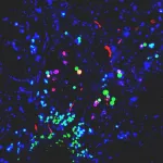 Nanoplastics promote conditions for Parkinson’s across various lab models