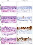 Nasal vaccine to prevent COVID-19 passes first tests