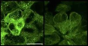 Neoself-antigens induce autoimmunity in lupus 2