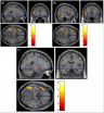 Neural sweet talk: Taste metaphors emotionally engage the brain