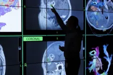 Neuro-oncology experts reveal how to use AI to improve brain cancer diagnosis, monitoring, treatment