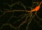 Neuroscientists discover new chemical pathway in the brain for stress