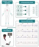 New AI tool simplifies heart monitoring: Fewer leads, same accuracy 2