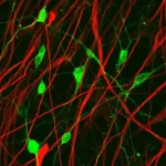 New anti-cancer therapy: Converting glioma cells into neurons