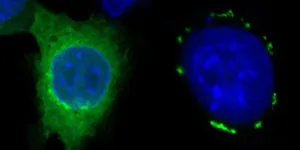 New approach in cancer therapy with innovative mechanism-of-action for ferroptosis induction