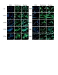 New bacterial toxins discovered: A key to fighting infections