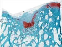 New biomaterial regrows damaged cartilage in joints 2