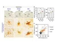 New brain cell cleaner: astrocytes raise possibility of Alzheimer’s disease treatment 2