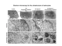 New brain cell cleaner: astrocytes raise possibility of Alzheimer’s disease treatment 3