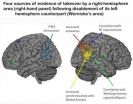 New Carnegie Mellon research reveals exactly how the human brain adapts to injury