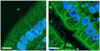 New culprit identified in metabolic syndrome