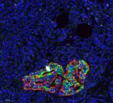 New DNA methylation-based method for precise assessment of pancreas cell composition