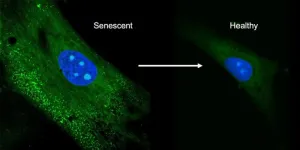 New drug delivery method can reverse senescence of stem cells