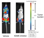 New epigenetic regulatory mechanisms involved in multiple myeloma growth