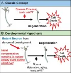 New evidence: Effects of Huntingtons disease mutation may begin in childhood