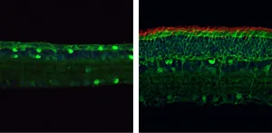 New gene-editing technique reverses vision loss in mice