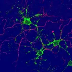 New glial cells discovered in the brain: Implications for brain repair