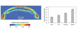 New imaging technique measures elasticity of multiple eye components simultaneously