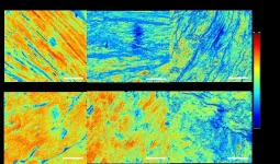 New imaging technique offers insight into Achilles tendon injury recovery