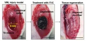 New “injectable tissue prosthesis coupled with closed-loop bioelectronic system” to aid in damaged muscle/nerve regeneration and robot-assisted rehabilitation 2