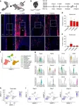 New insights into heterotopic ossification: Progenitor cells play a key role in aberrant bone formation