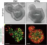 New insights into how gut cells respond to bacterial toxins