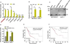 New insights into how RNA modification promotes pancreatic cancer