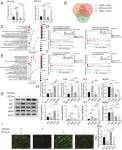 New insights into intervertebral disc degeneration: role of oxygen concentration and HIF1A in nucleus pulposus cells