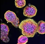 New insights into liver cancer using organoids