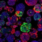 New insights into liver cancer using organoids 2